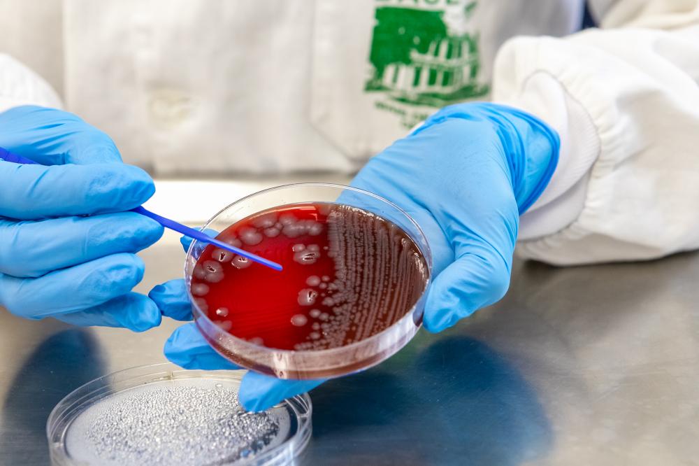 Doenças gastrointestinais: com 389 mil casos neste ano, Saúde alerta para prevenção. Foto: Roberto Dziura Jr/AEN